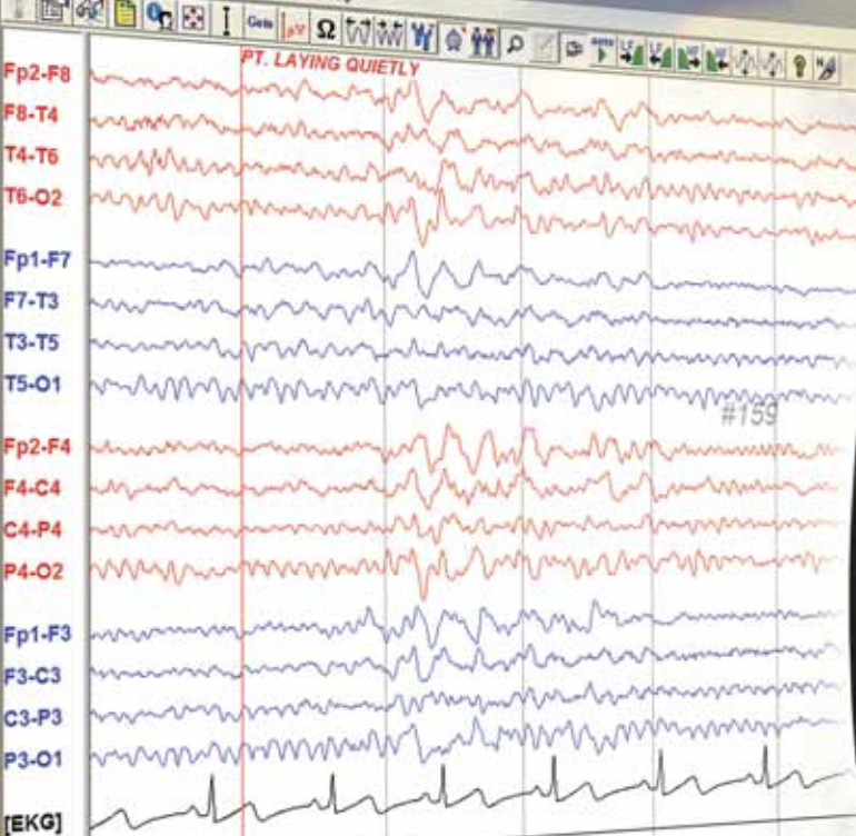 EEG Signals