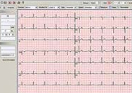 ECG2